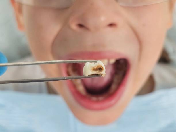 Best Emergency Treatment for Jaw Pain or Injury in Woodbury, TN
